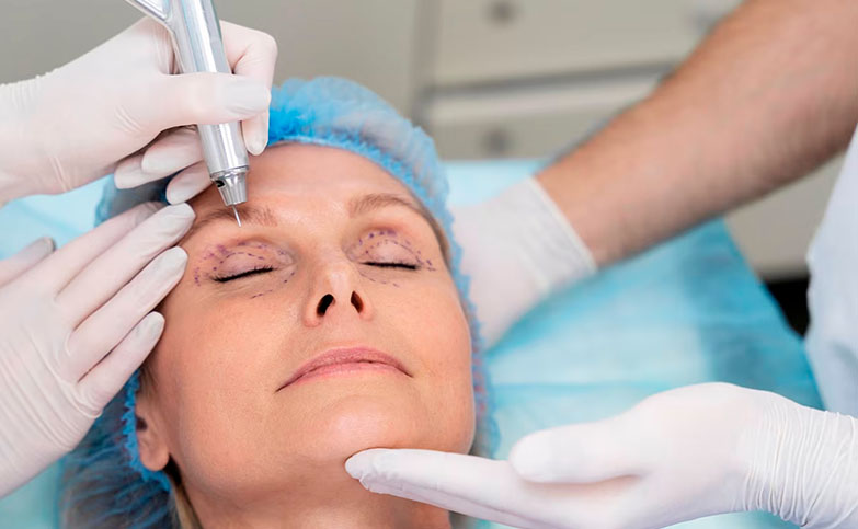 Blefaroplastia_procedimentos